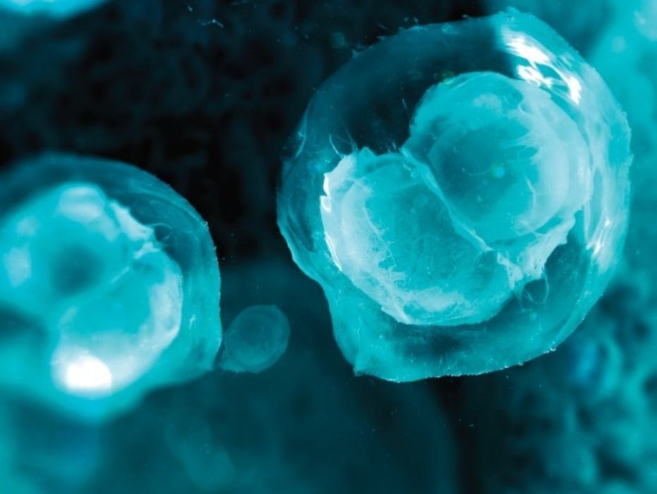 ¿Qué es el congelamiento de óvulos, en dónde puedo hacerlo?