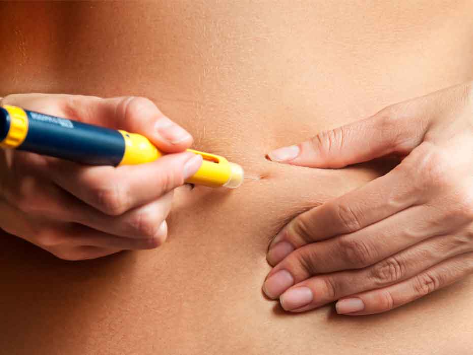 Diferencias entre fecundación in vitro e inseminación artificial